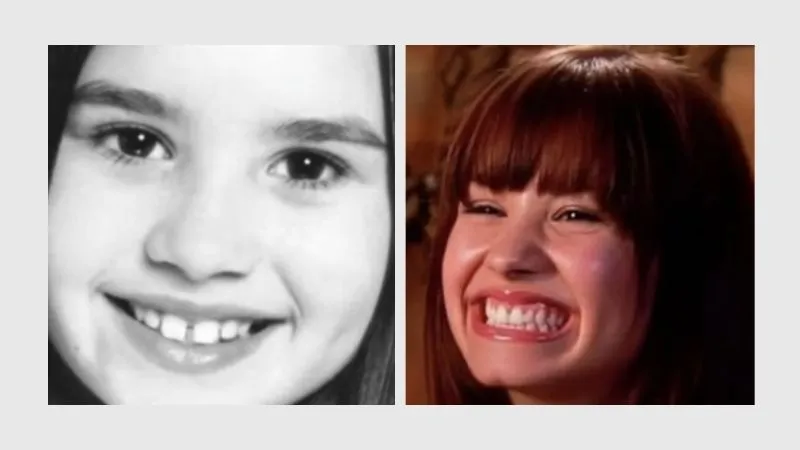 Demi Lovato Teeth