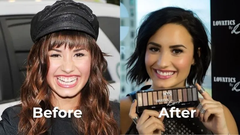 Demi Lovato teeth Demi Lovato teeth