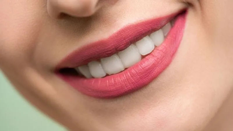 Is Hollywood Smile Worth It