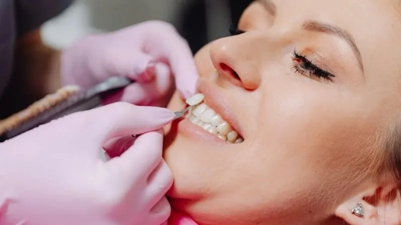 Hollywood Smile Hollywood Smile